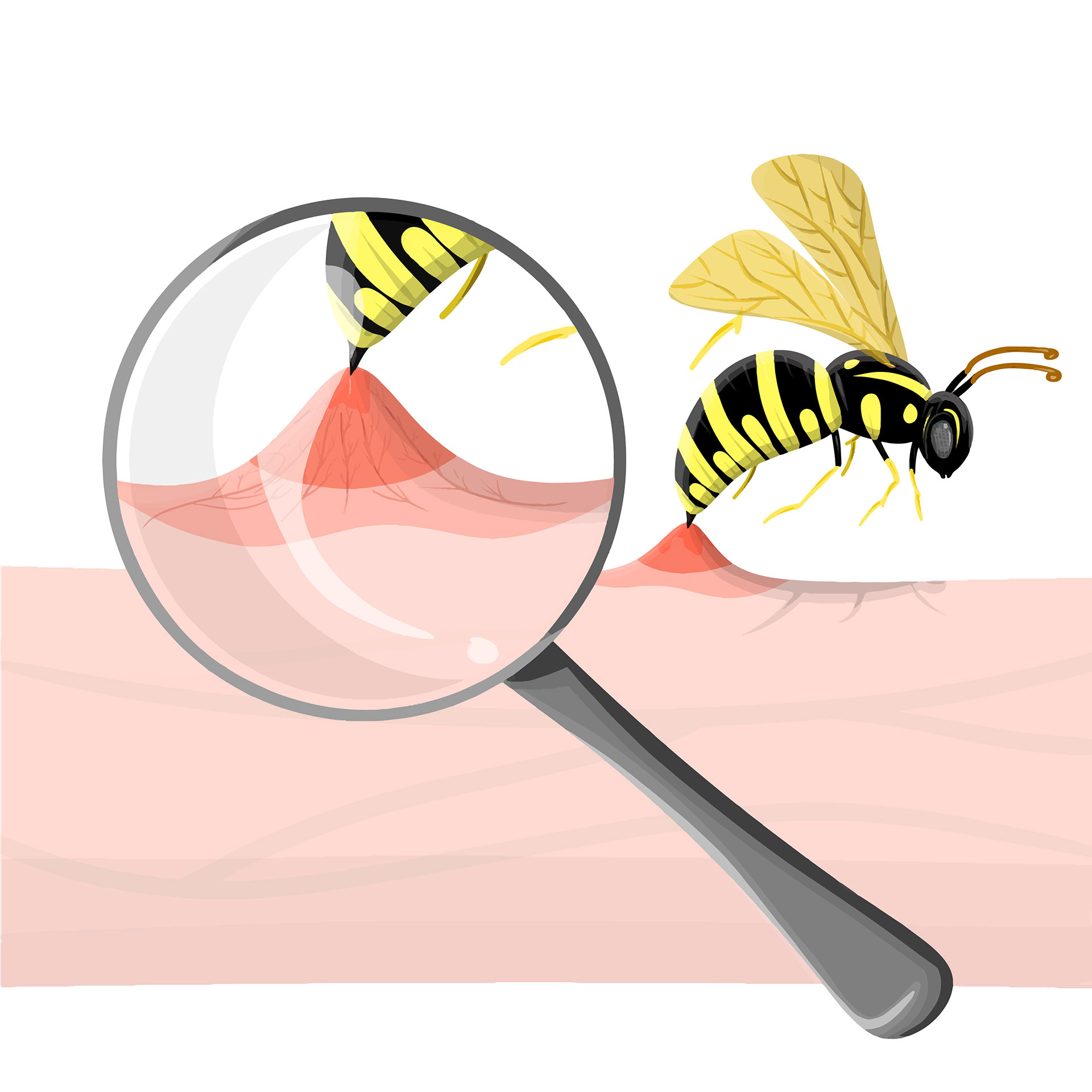 Health Risks Posed by Aggressive Bees and Wasps - The Bee Hunter